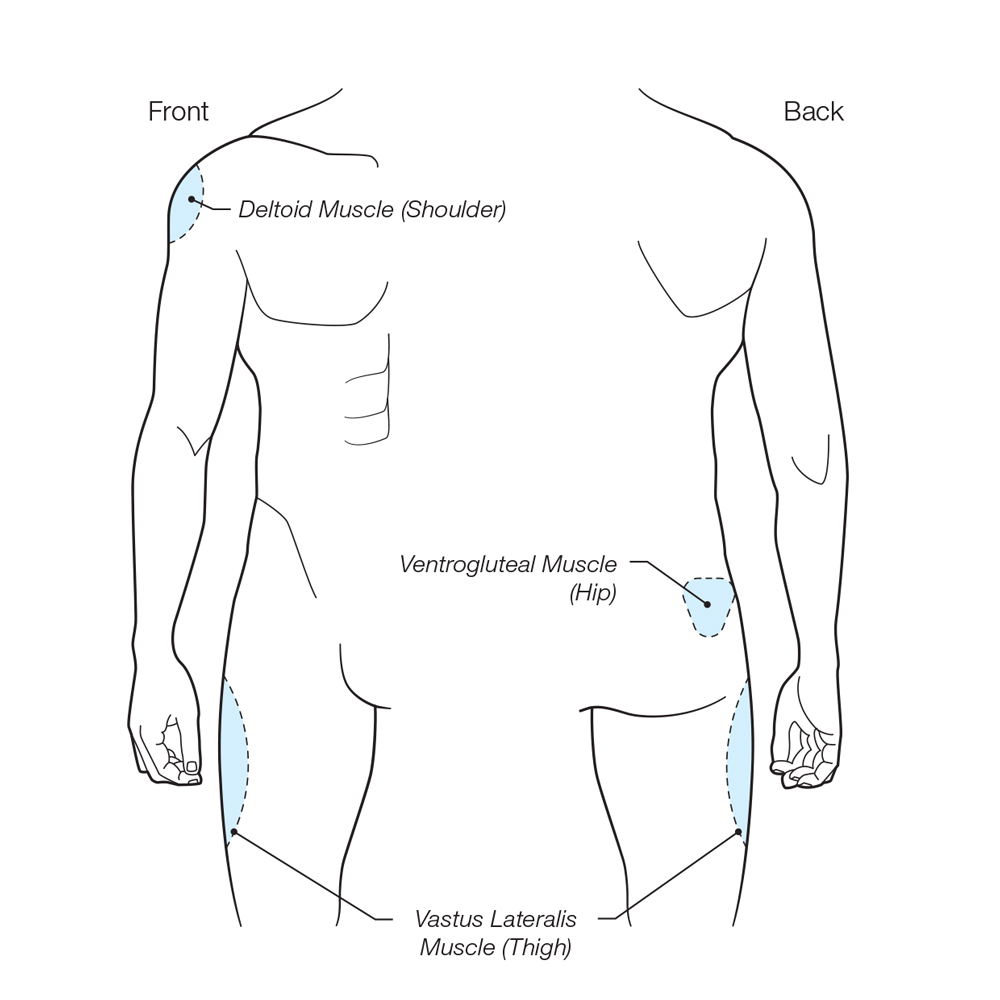 intramuscular injection instructions graphic