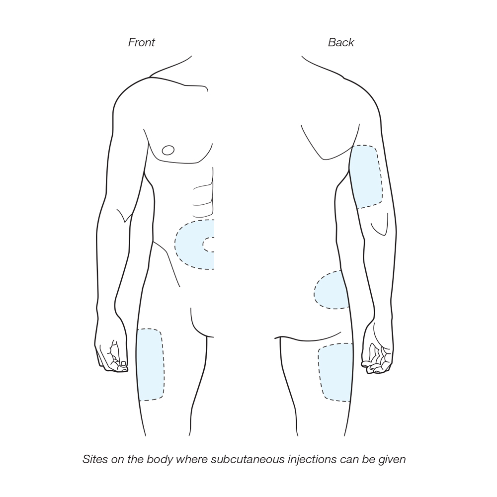 subcutaneous injection instructions graphic